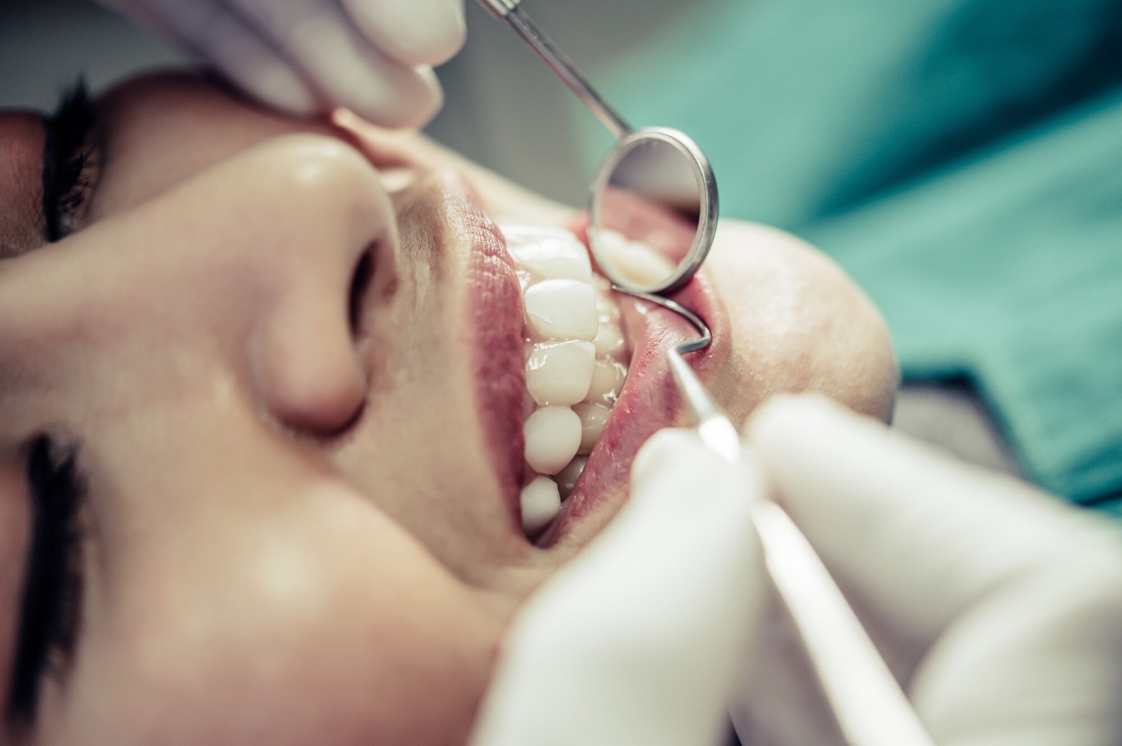 Instruments in place during a filling procedure