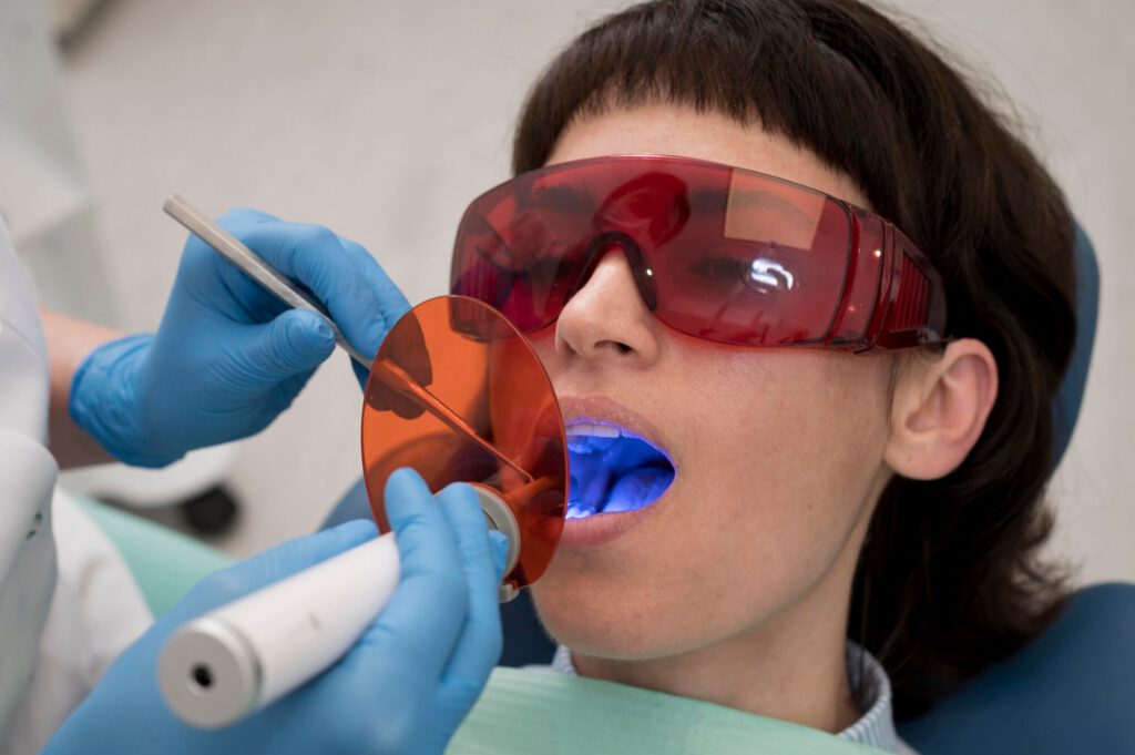 Composite bonding material being shaped onto a front tooth