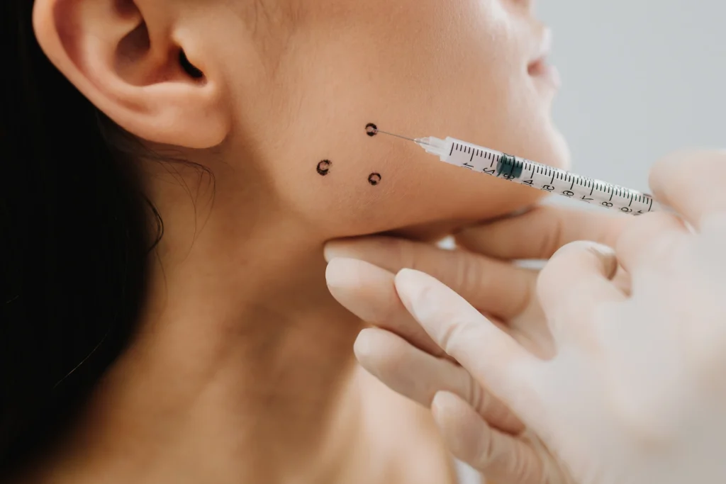 Gloved hands hold a syringe near marked injection points on a person's jawline